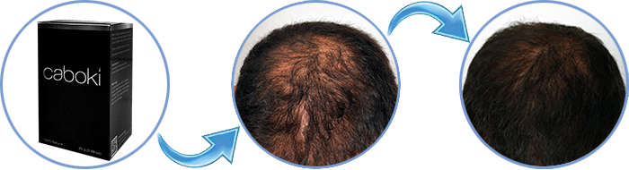 Инструкция по применению загустителя Caboki.